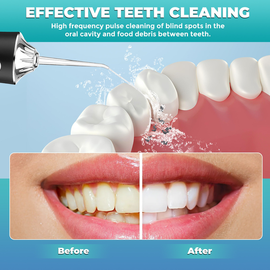 ⏳ Time-Limited Special! ⏰ Portable Oral Irrigator – Water Flosser! 💧🦷