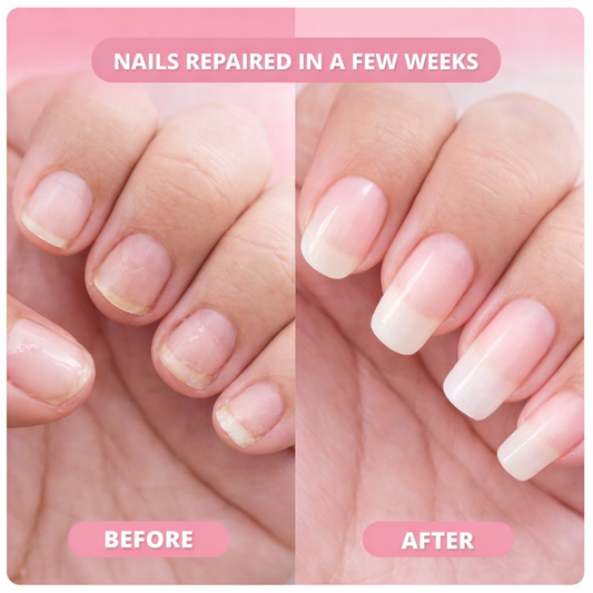 ™ NailRevive Growth Serum
