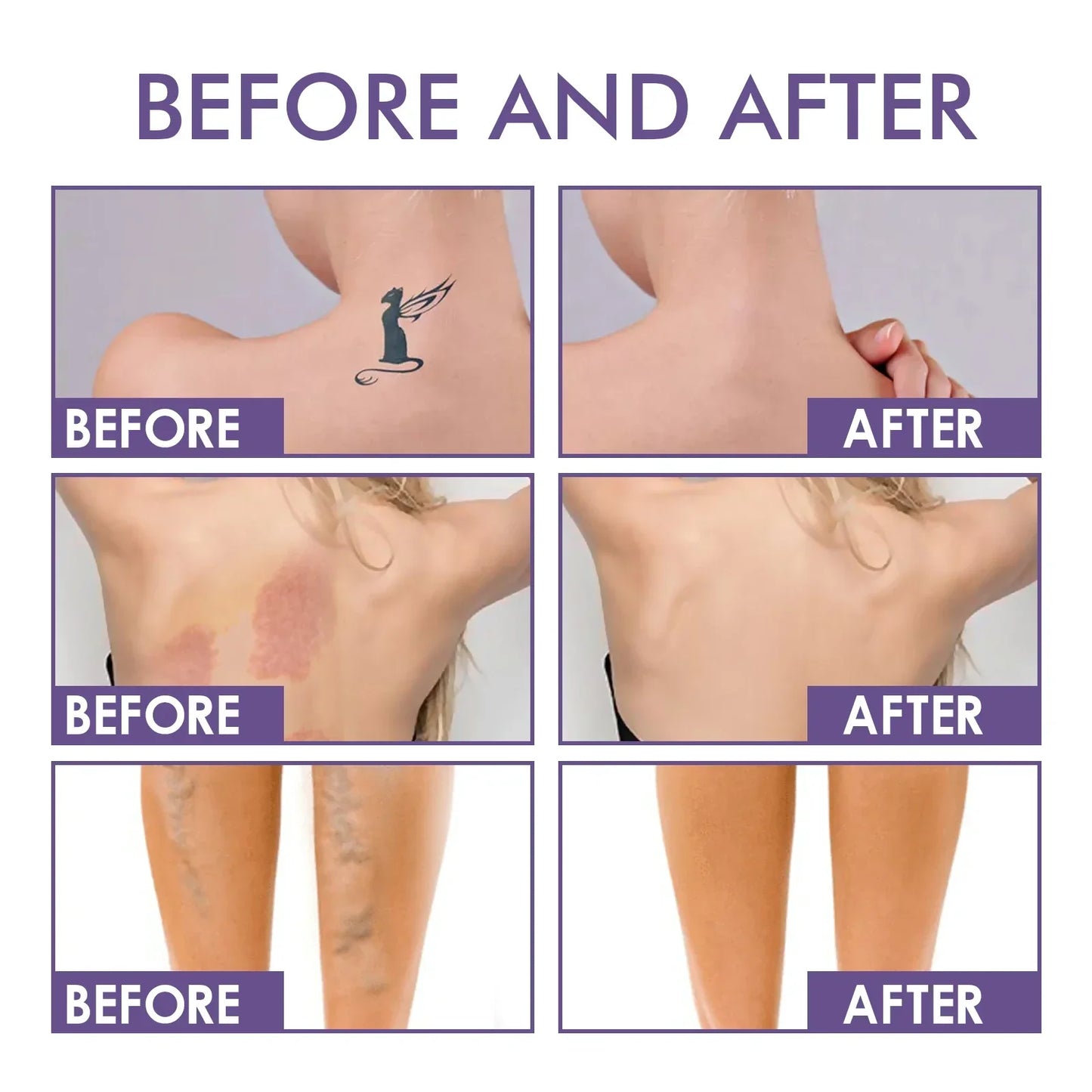 Norvia Body Perfector