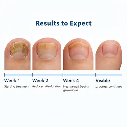 NORVIA™ Fungal Nail Patches